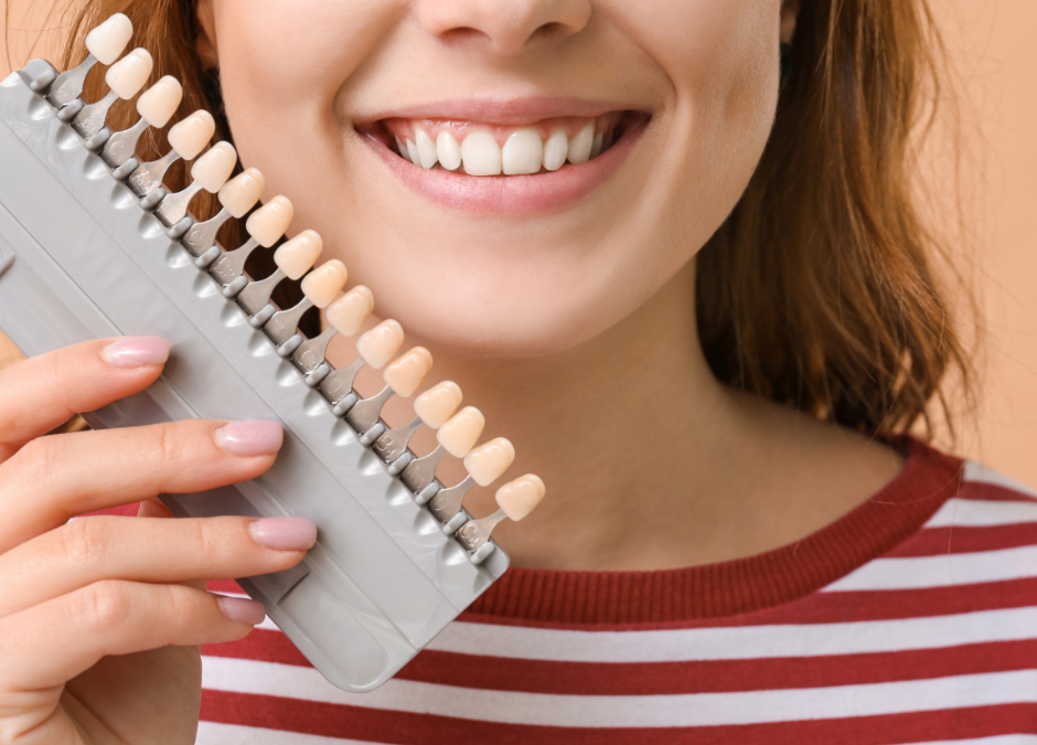 How Dental Veneers Can Help Improve Your Smile