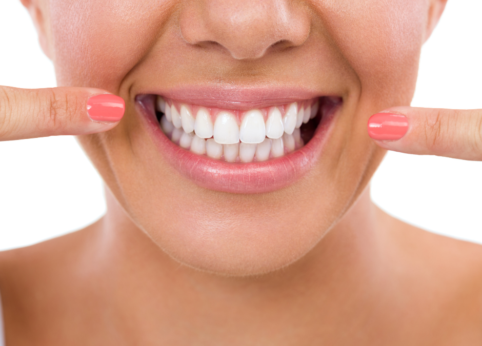 How to Help Yourself Avoid Stained Teeth – Dentist in Cooper City/Davie FL