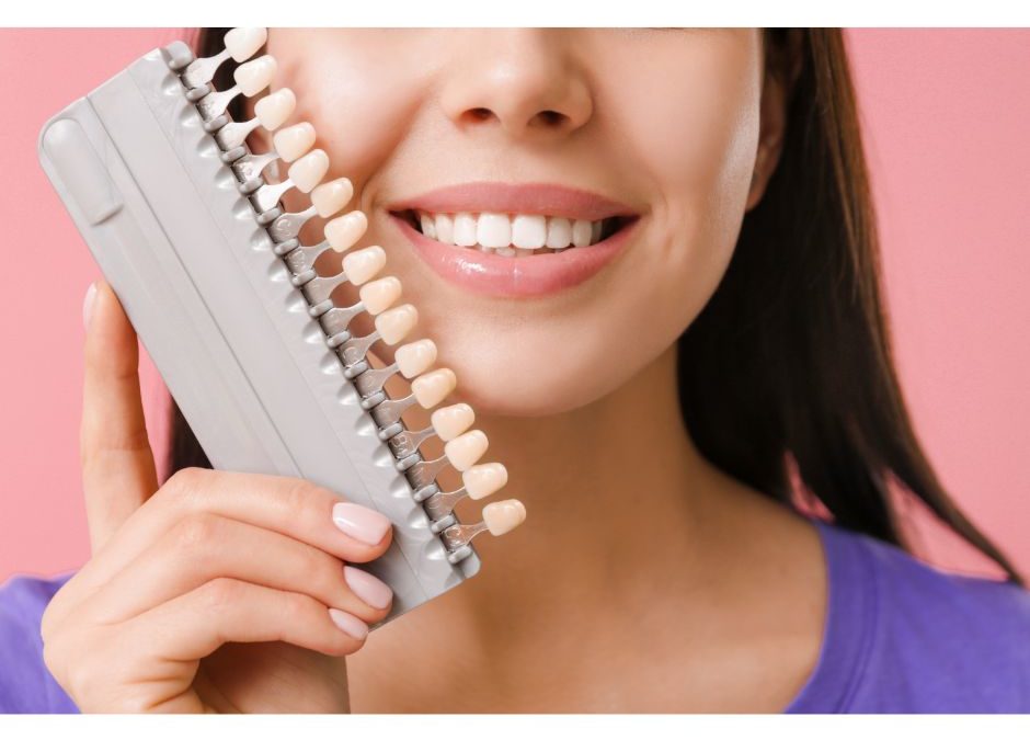 All you need to know about veneers from your Cooper City/Davie, Florida dentist office