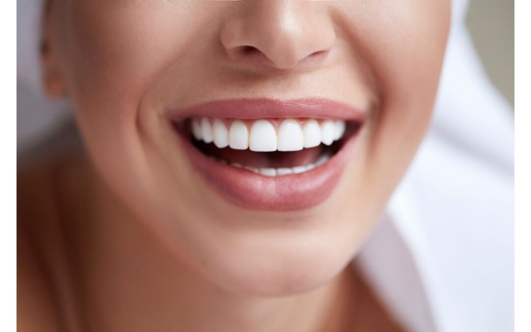 Enhance Your Smile and Confidence with Teeth Whitening at Miracle Dental Center, Cooper City and Davie, FL